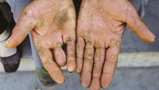 Arsenik Özellikleri ve Faydaları Nelerdir?