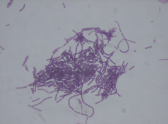 Bacillus Thuringiensis Özellikleri ve Faydaları Nelerdir?