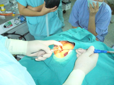 Lokal Anestezi Özellikleri ve Faydaları Nelerdir?